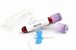 Próbka krwi do badania hemoglobiny glikowanej