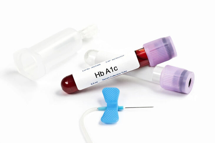 Próbka krwi do badania hemoglobiny glikowanej