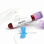 Próbka krwi do badania hemoglobiny glikowanej