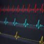 Bradykardia na monitorze
