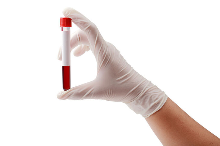 Diagnosta trzyma w dłoni ampułkę z krwią