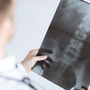 Lekarz diagnozuje naczyniaka kręgosłupa