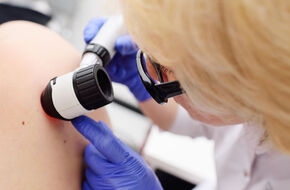 Dermatolog ogląda skórę