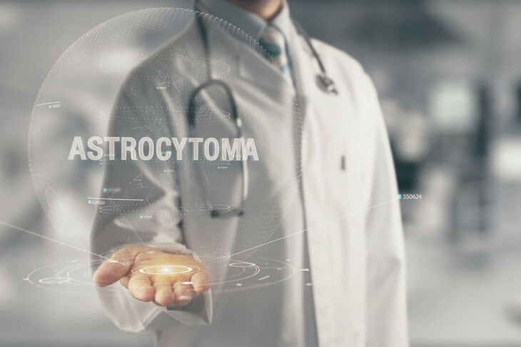 Lekarz i wizualizacja dotycząca gwiaździaka 