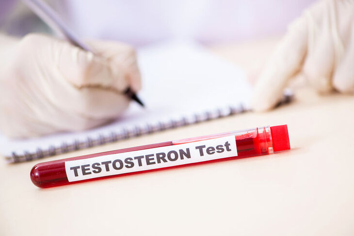 Badanie testosteronu