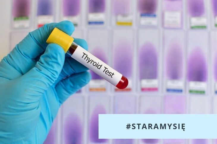Napis TSH test na probówce