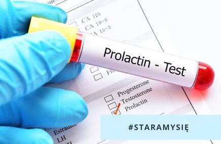 Test prolaktyny