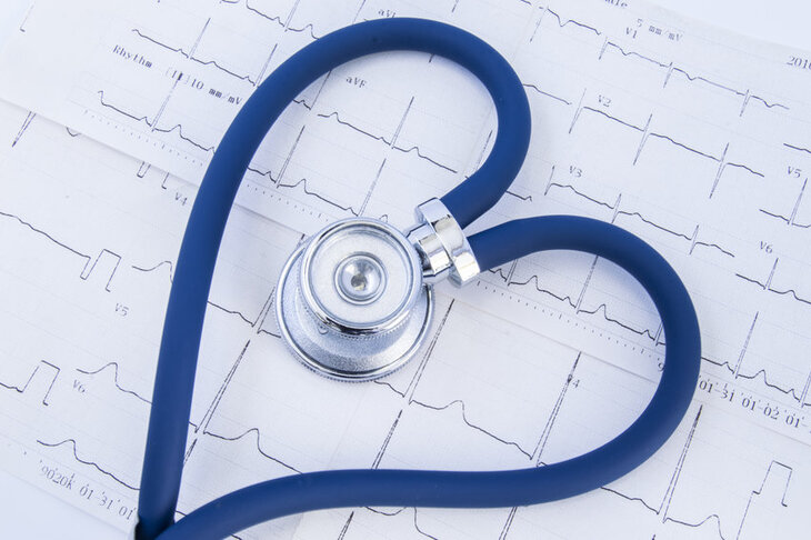 Trzepotanie przedsionków z zapisu EKG