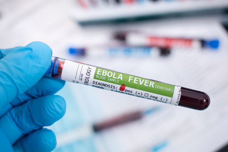 Próbka krwi z wirusem ebola