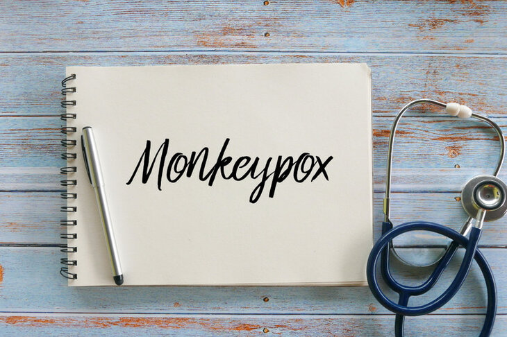 Diagnostyka małpiej opsy