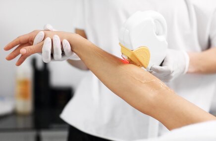 Depilacja włosów na ręku przy pomocy laseroterapii