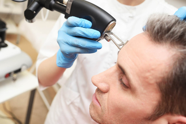 Użycie lasera frakcyjnego w dermatologa
