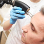 Użycie lasera frakcyjnego w dermatologa