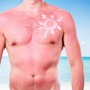 Mężczyzna ze schodzącą skórą po opalaniu stoi na plaży