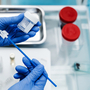 Wykonanie cytologii płynnej