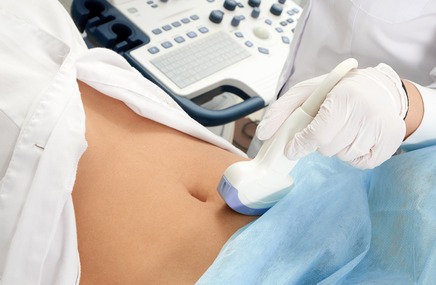 Badanie usg w celu diagnozy skrętu jajników