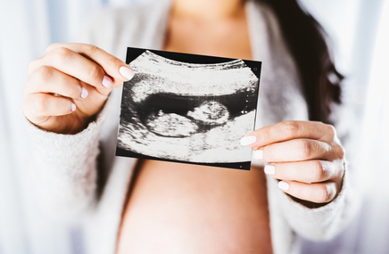 Kobieta w 25 tygodniu ciąży trzyma zdjęcie z USG