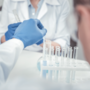 Badanie nad wykorzystaniem prostaglandyny F2α w leczeniu alzheimera i parkinsona