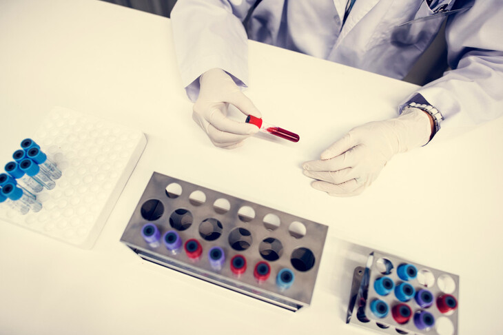 Zdjęcie przedstawia laboranta w rękawiczkach trzymającego próbkę krwi, co może sugerować przygotowanie do analizy, takiej jak proteinogram, w celu oceny poziomu białek we krwi.