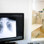 Zdjęcie przedstawia obraz rentgenowski płuc, co sugeruje diagnostykę chorób układu oddechowego, takich jak gruźlica.