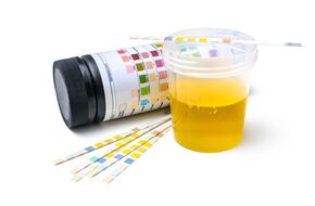 Próbka moczu do badania escherichia coli