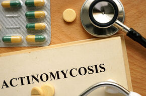 Diagnostyka promienicy