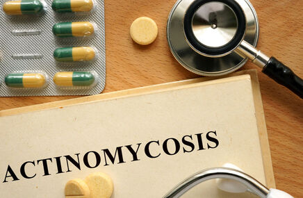 Diagnostyka promienicy