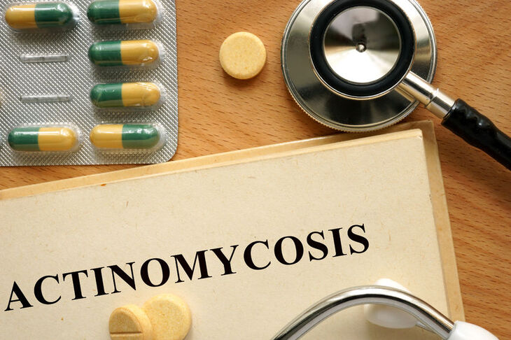 Diagnostyka promienicy