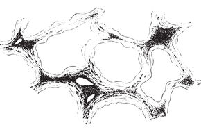 Diagnostyka pylicy w płucach