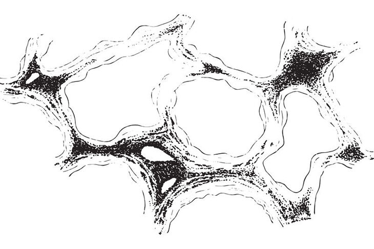 Diagnostyka pylicy w płucach