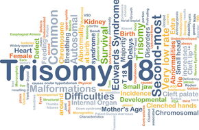 Napis trisomia chromosomu 18